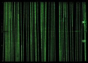 JIS TypeⅠ試験片での探傷結果画像